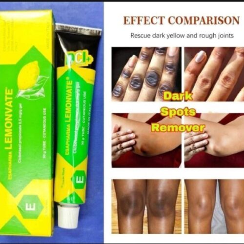 Lemonvate Cream - 30gm (Italy)