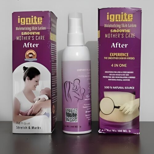 gnite Stretch & Marks Remover Body Lotion After Use - 100ML